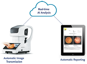 Retinal images are transferred for real-time AI analysis and an automatic report is returned