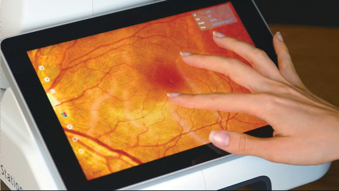 Pinch-to-zoom review of a retinal image on the RetinaStation tablet